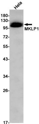 MKLP1 Rabbit mAb