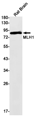 MLH1 Rabbit mAb