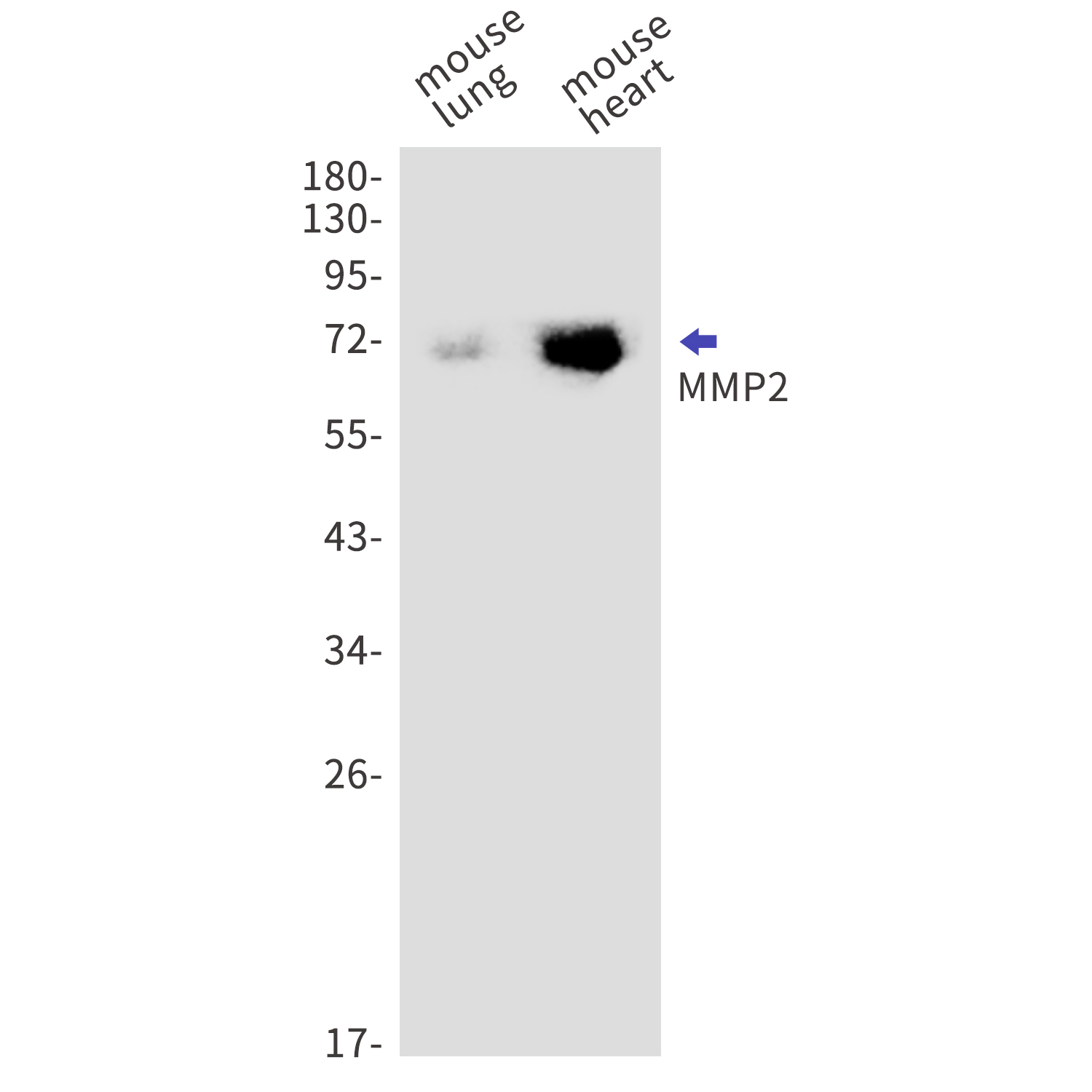 MMP2 Rabbit mAb