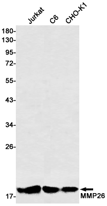 MMP26 Rabbit mAb