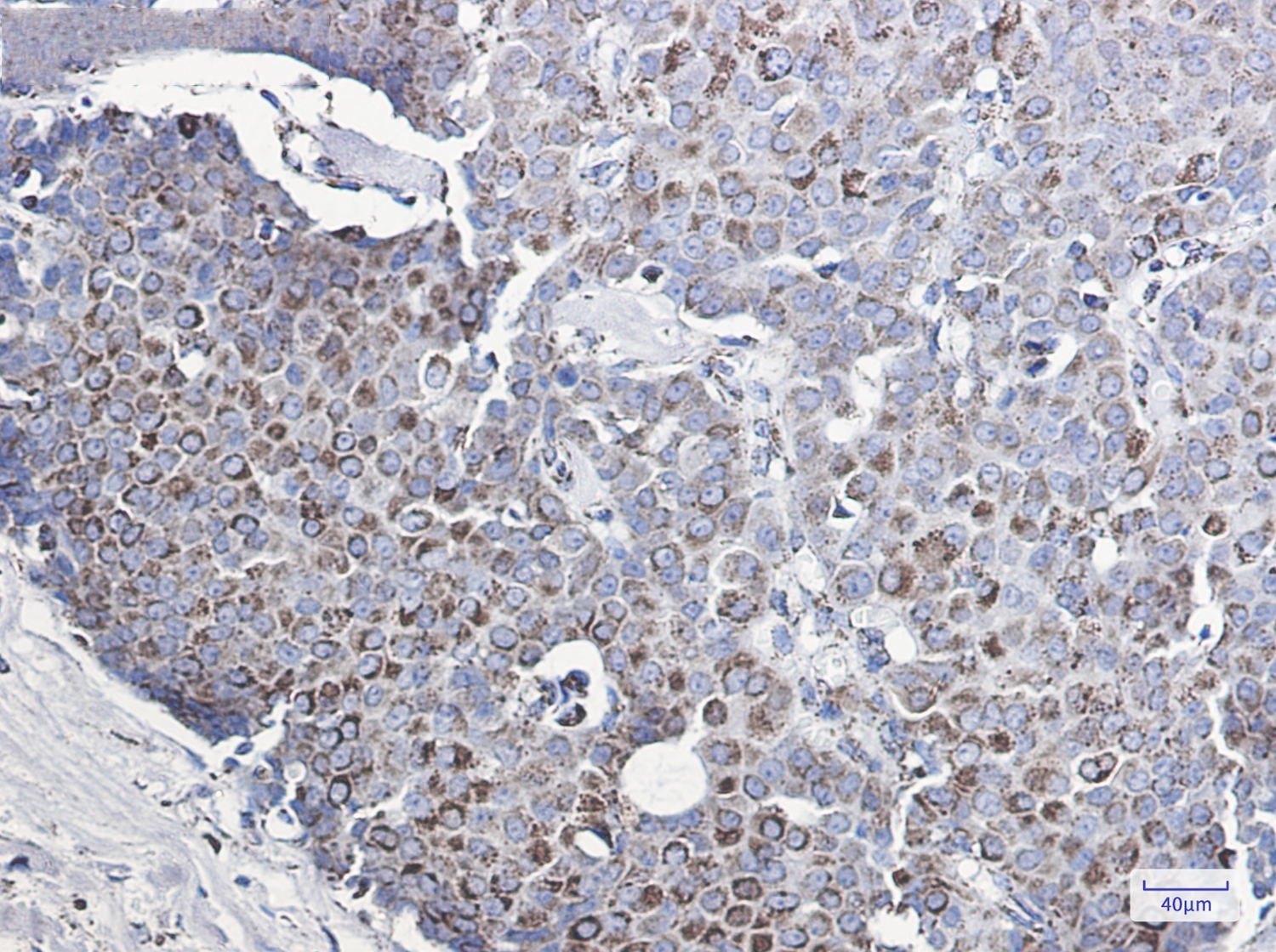 MMP3 Rabbit mAb