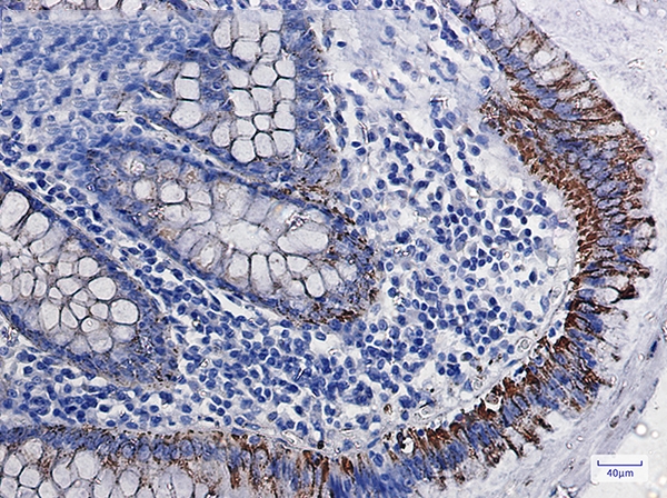 Monoamine Oxidase A Rabbit mAb