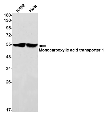 Monocarboxylic Acid Transporter 1 Rabbit mAb