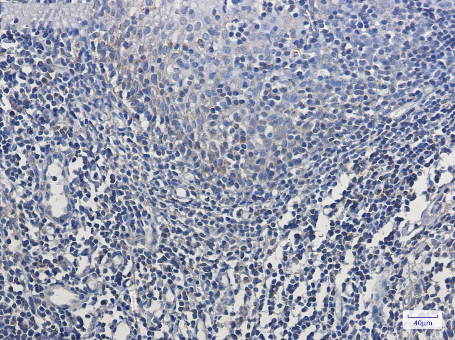 MTCO2 Rabbit mAb