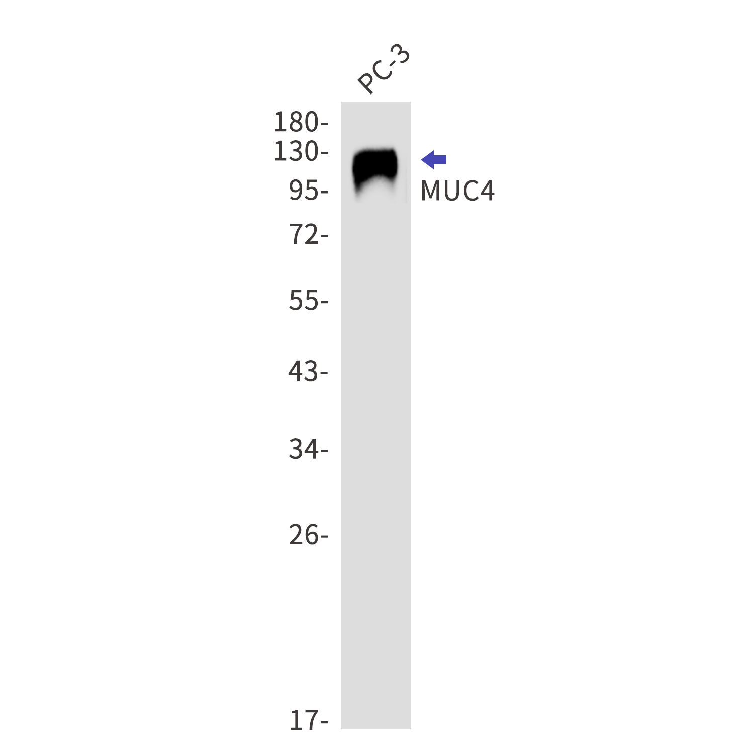 Mucin 4 Rabbit mAb