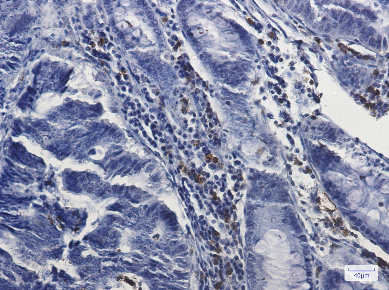 Myeloperoxidase Rabbit mAb