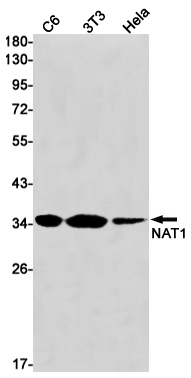 NAT1 Rabbit mAb