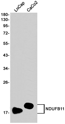 NDUFB11 Rabbit mAb