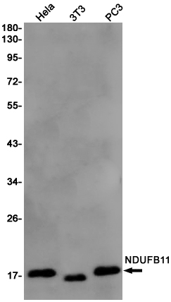 NDUFB11 Rabbit mAb