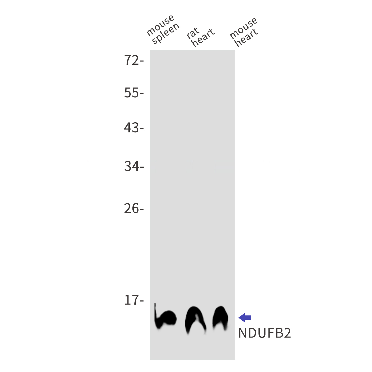 NDUFB2 Rabbit mAb