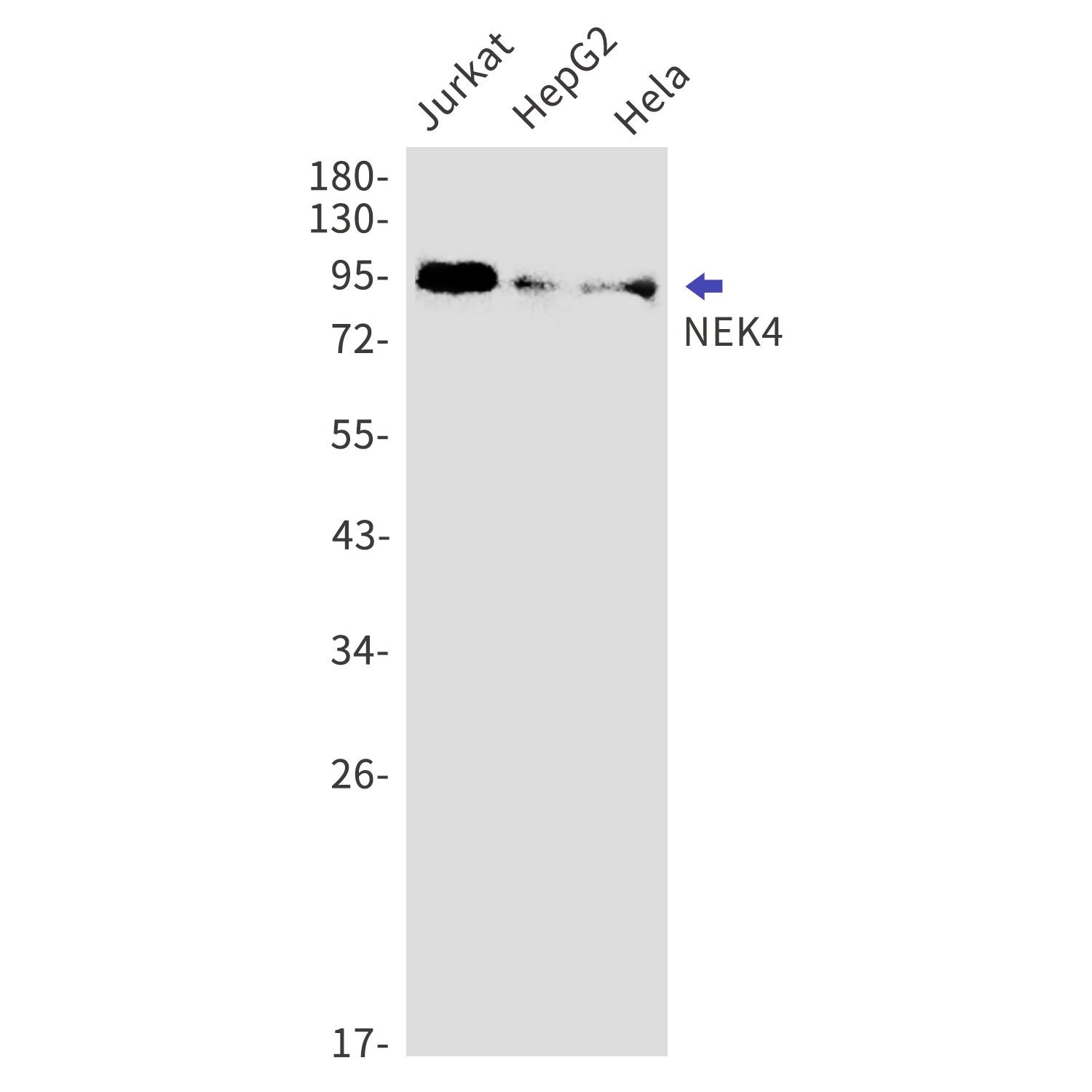 NEK4 Rabbit mAb