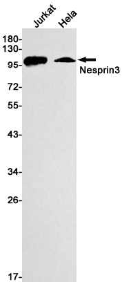 Nesprin3 Rabbit mAb