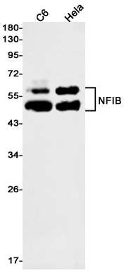 NFIB Rabbit mAb