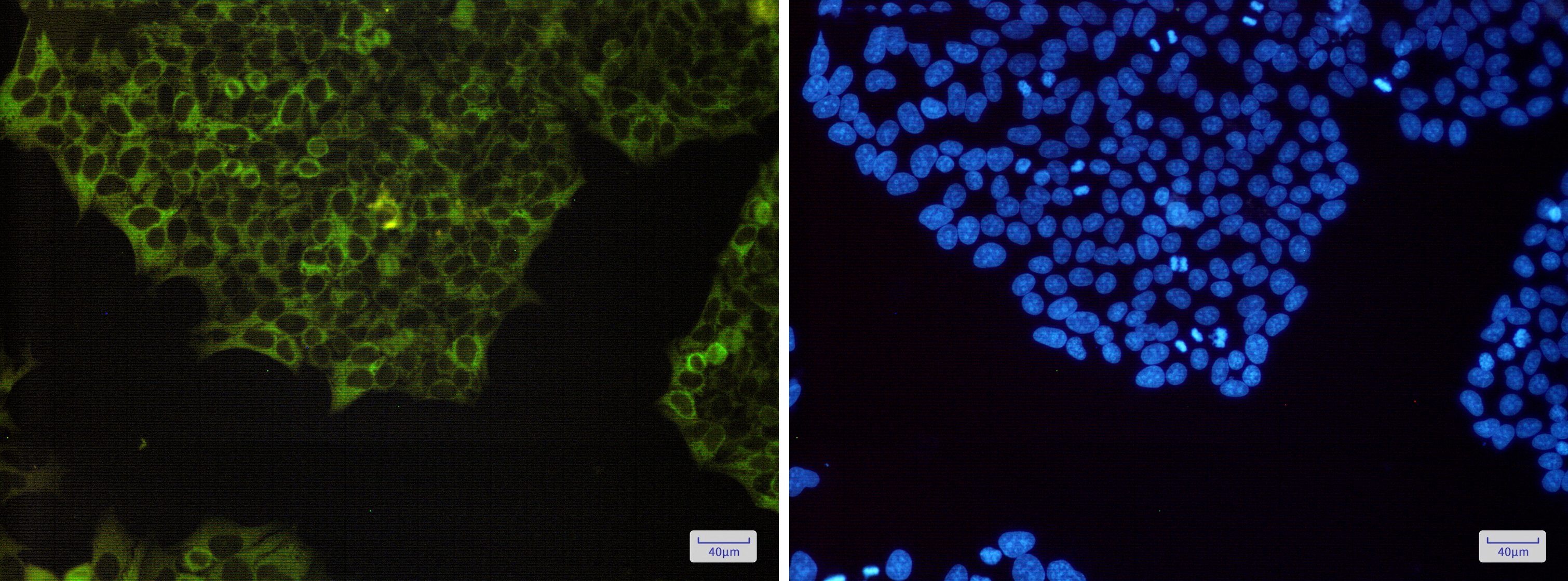 NF kappa B p100 Rabbit mAb