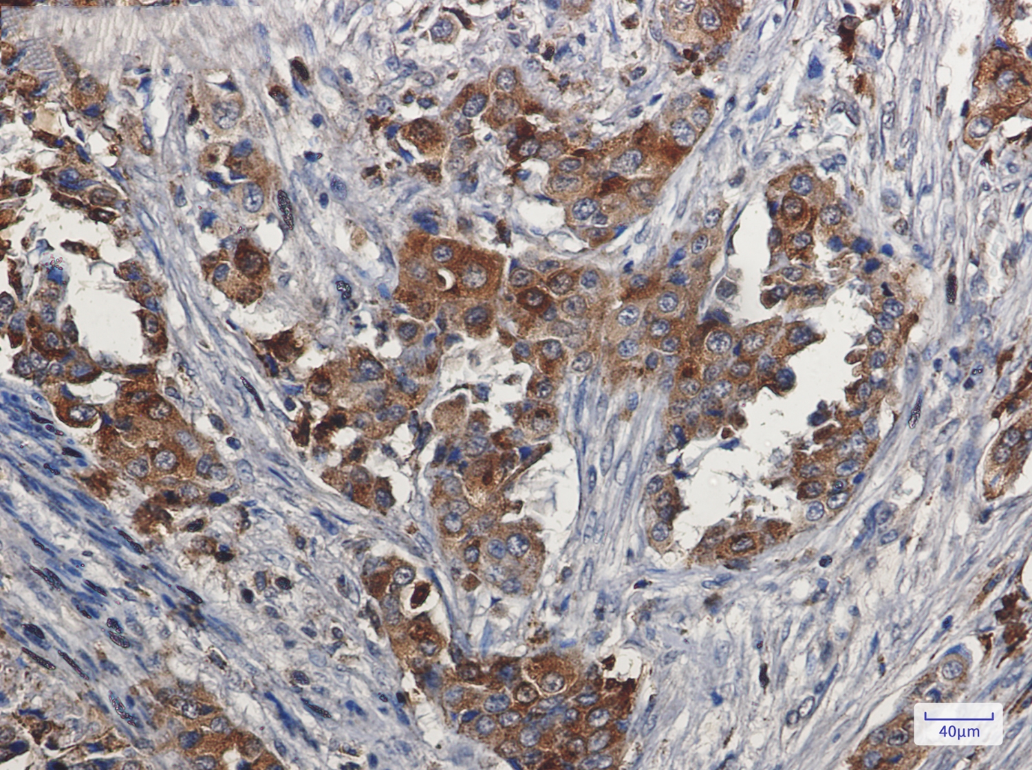 Niemann Pick C2 Rabbit mAb