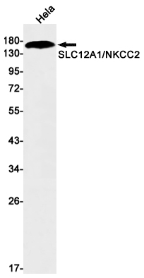 SLC12A1 Rabbit mAb