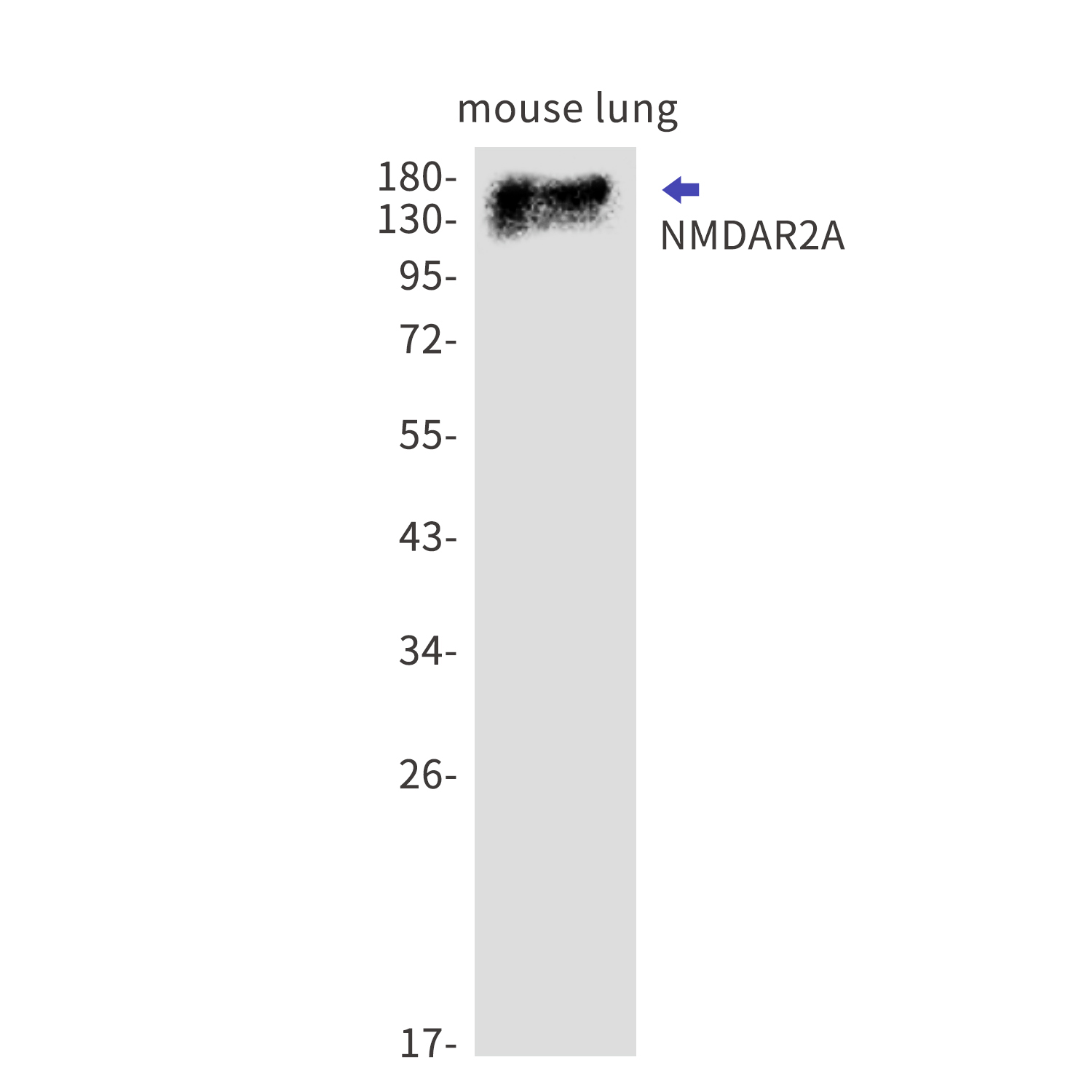 NMDAR2A Rabbit mAb