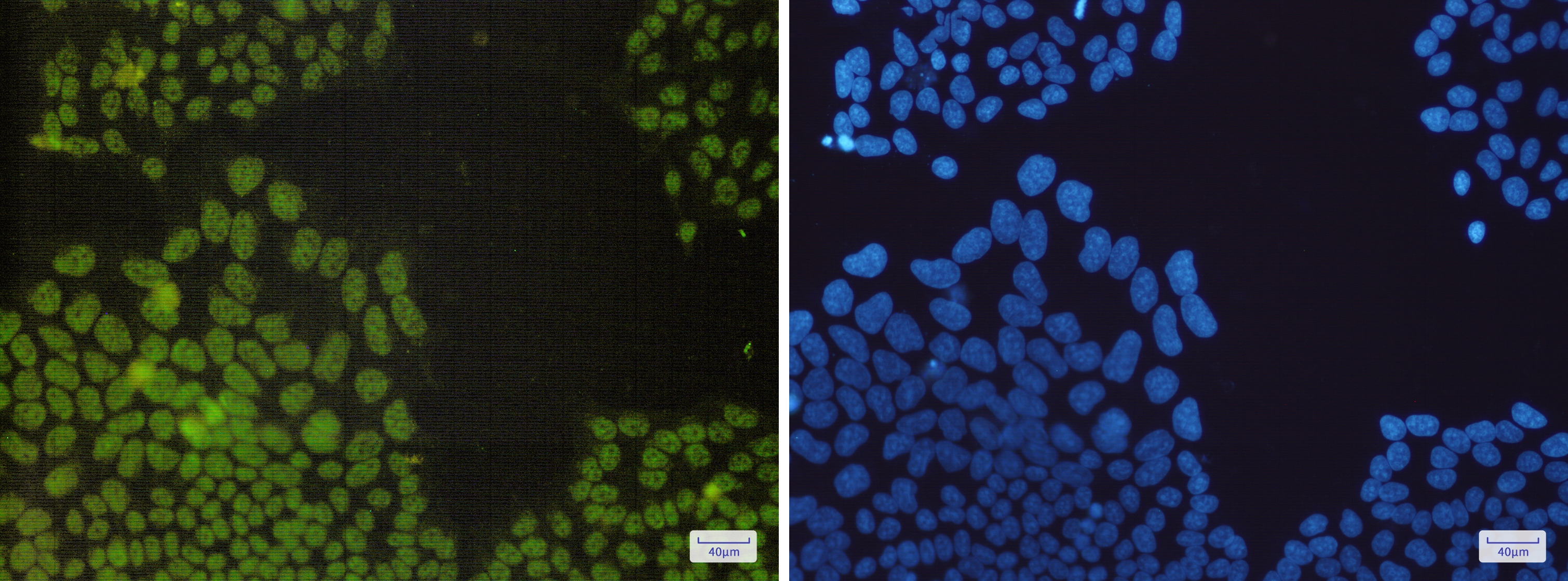 Nrf1 Rabbit mAb