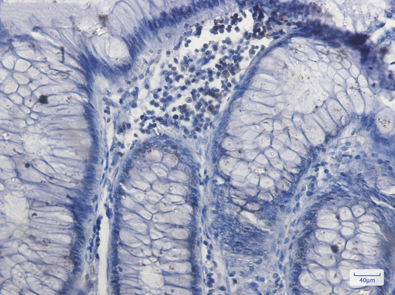 Nrf1 Rabbit mAb