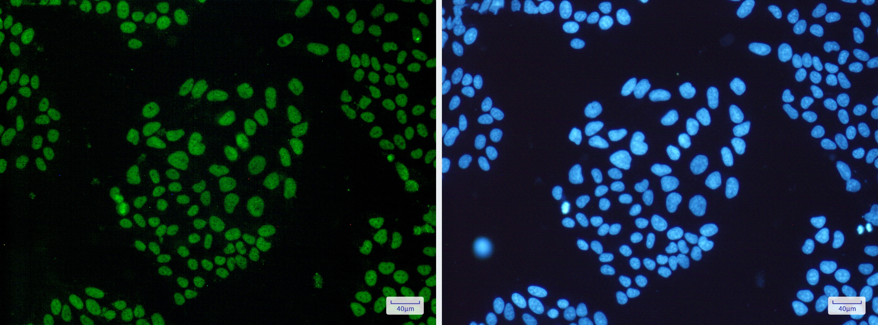 THO Complex Subunit 1 Rabbit mAb