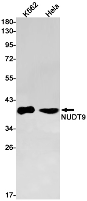 NUDT9 Rabbit mAb