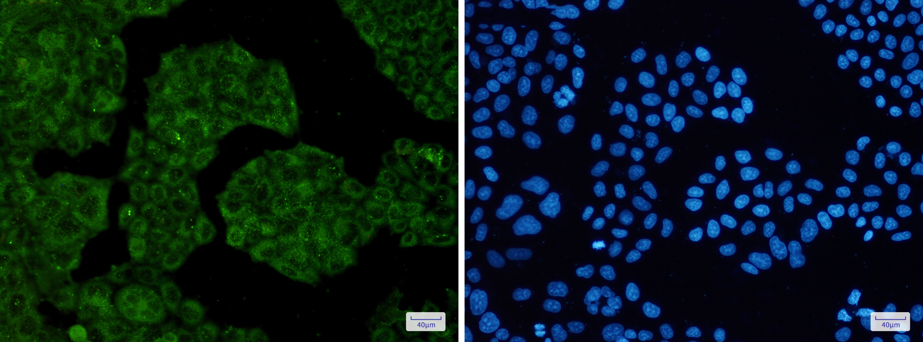 NUDT9 Rabbit mAb