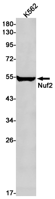 Nuf2 Rabbit mAb