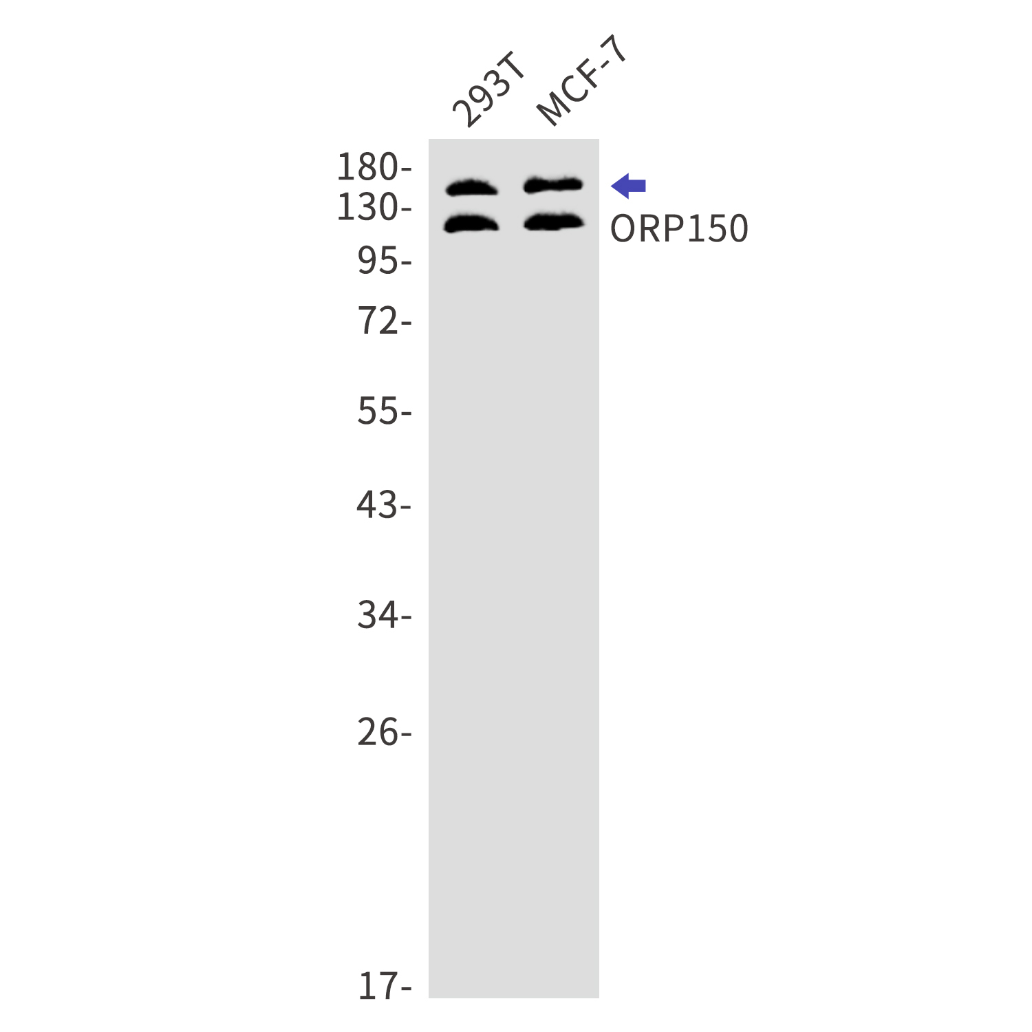 ORP150 Rabbit mAb