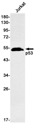 p53 Rabbit mAb