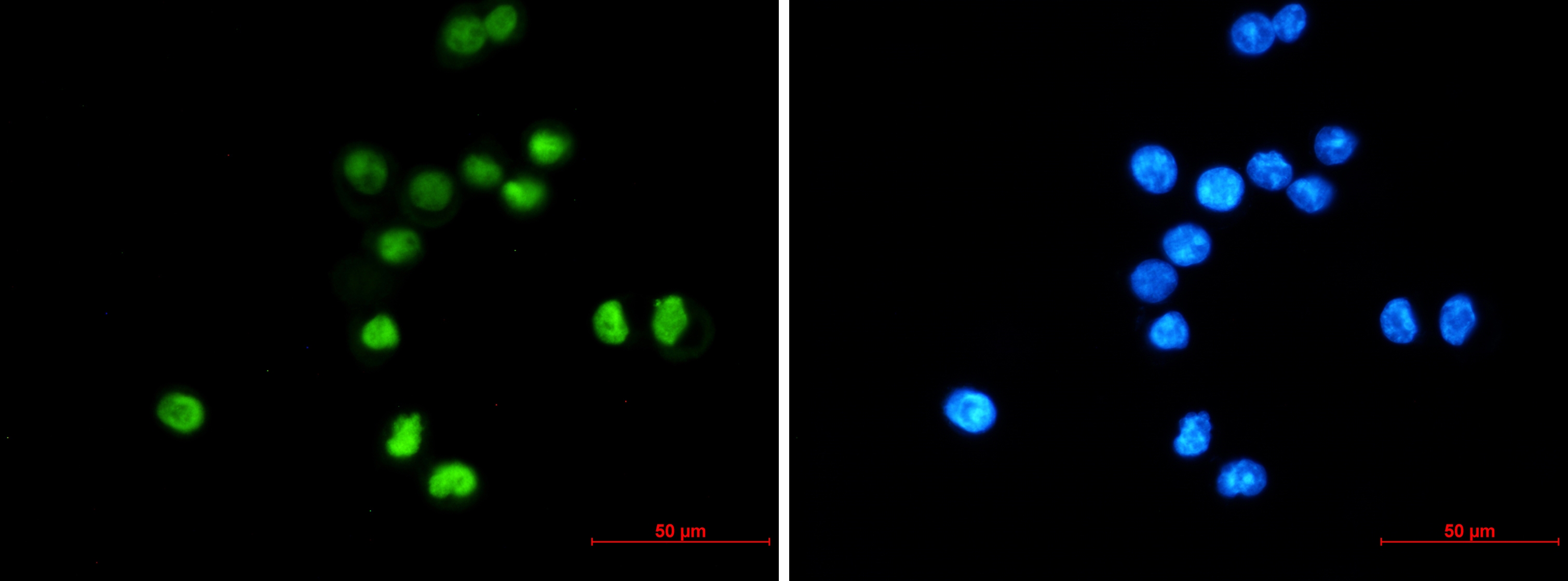 p53 Rabbit mAb