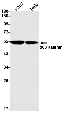 p60 Katanin Rabbit mAb