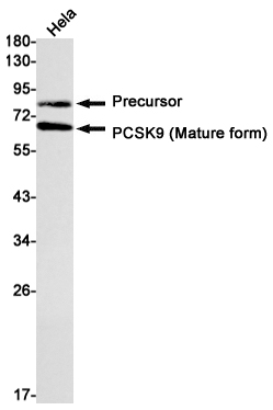 PCSK9 Rabbit mAb