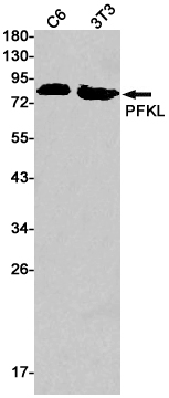 PFKL Rabbit mAb