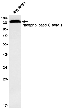 Phospholipase C beta 1 Rabbit mAb