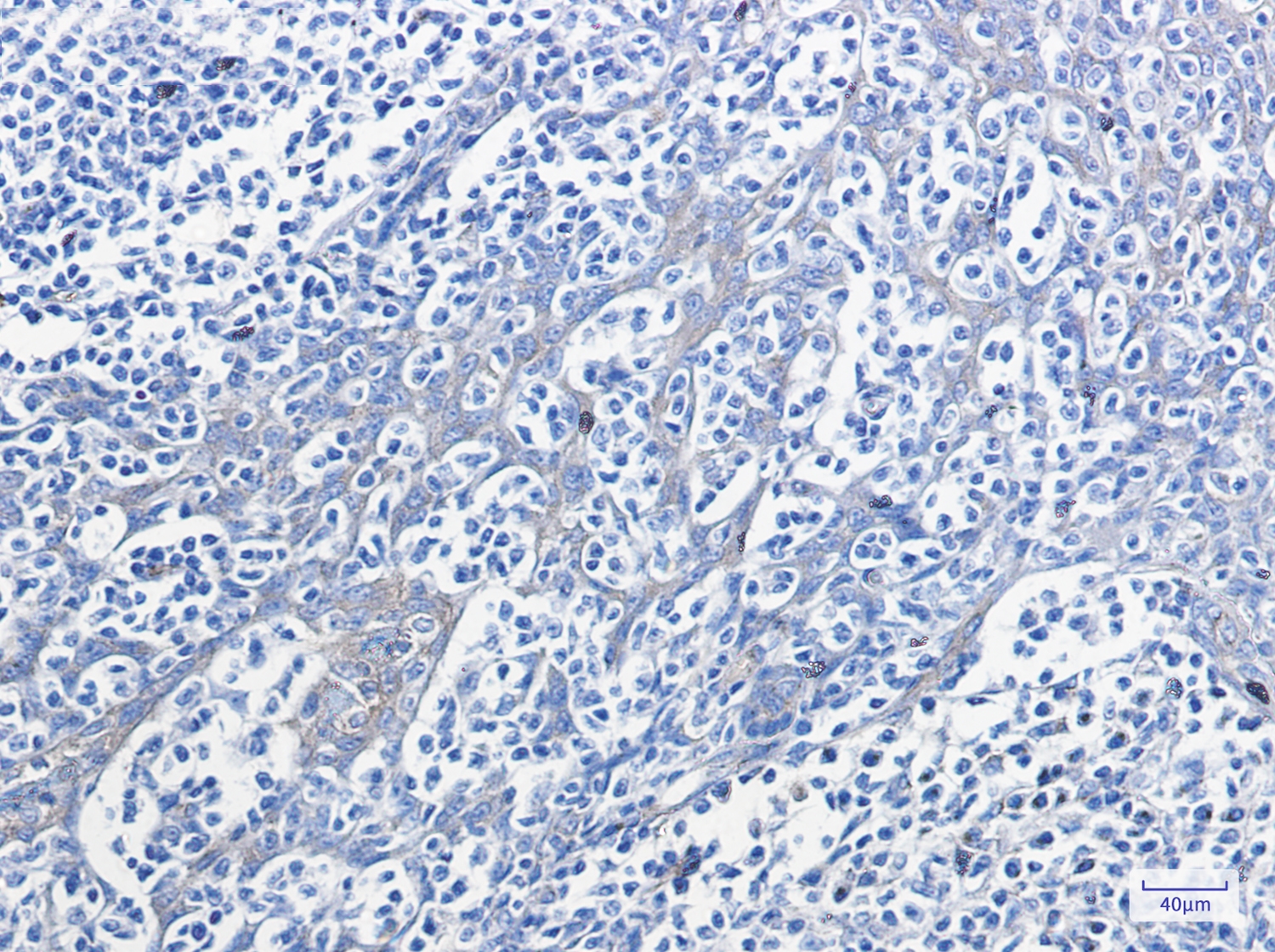 Phospho-PKA RII alpha (Ser99) Rabbit mAb