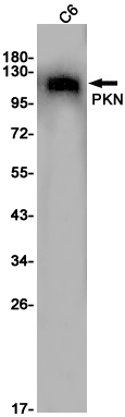 PKN1 Rabbit mAb