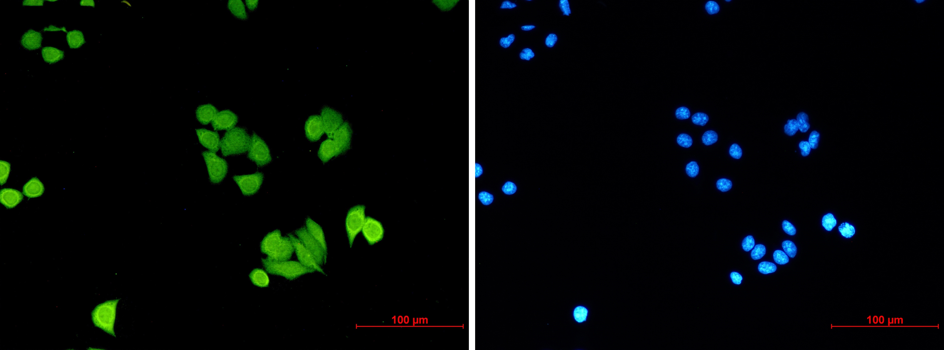 PLK1 Rabbit mAb