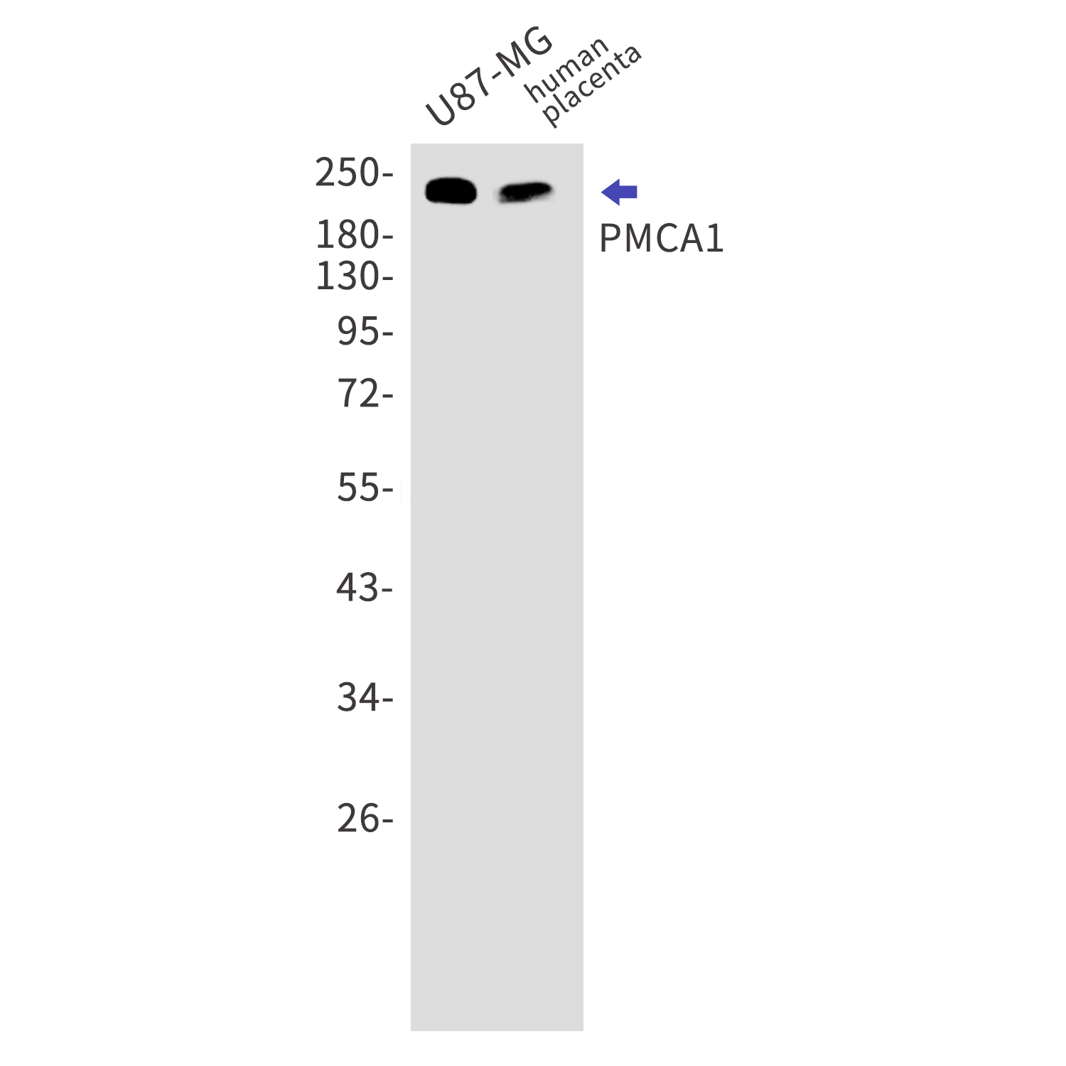 PMCA1 Rabbit mAb