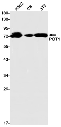 POT1 Rabbit mAb