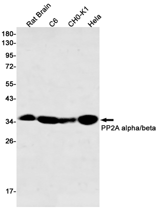 PP2A alpha/beta Rabbit mAb