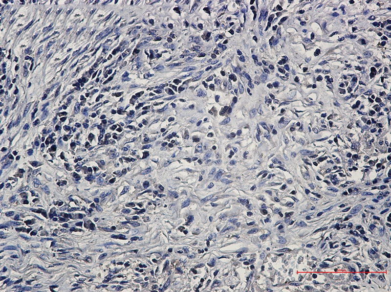 PP2A alpha/beta Rabbit mAb