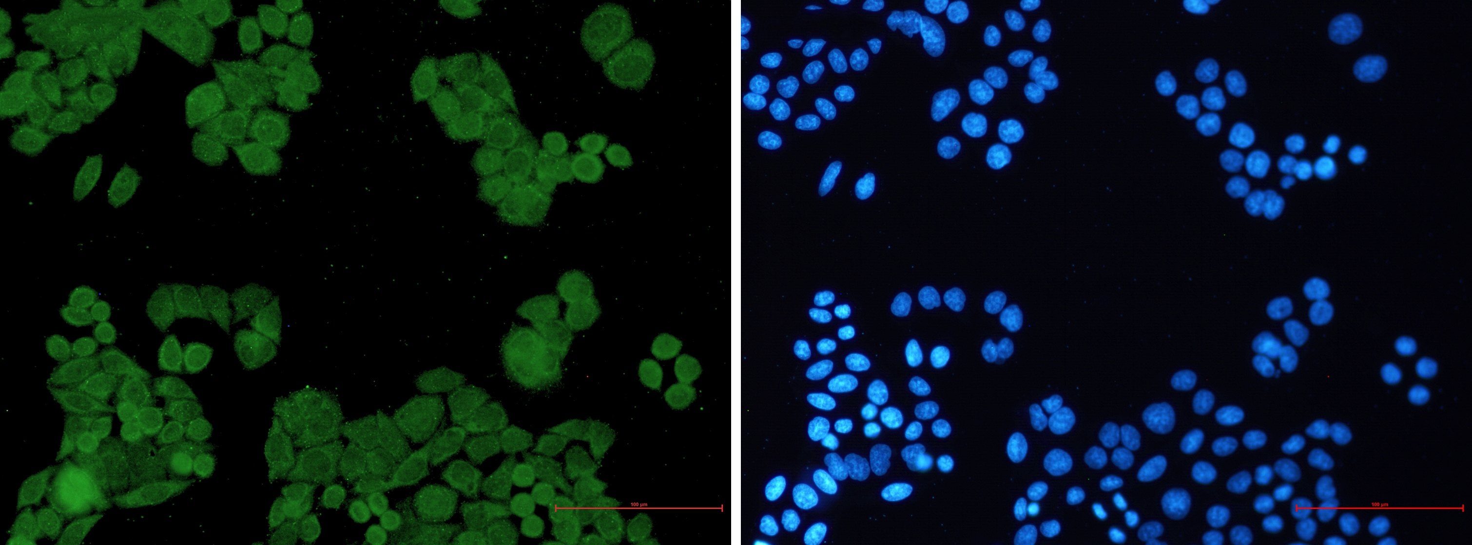 PP2A alpha/beta Rabbit mAb