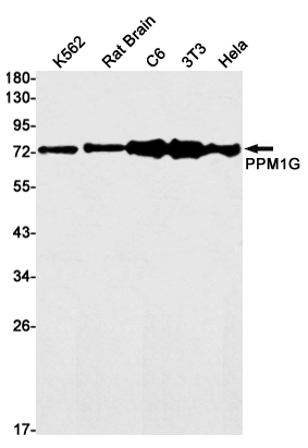 PPM1G Rabbit mAb