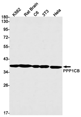 PP1C beta Rabbit mAb