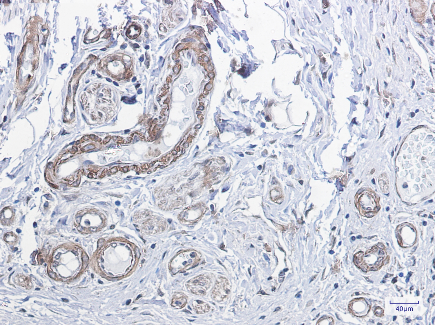 PP1C beta Rabbit mAb