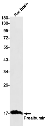 Prealbumin Rabbit mAb