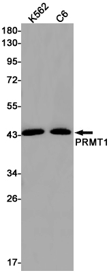 PRMT1 Rabbit mAb