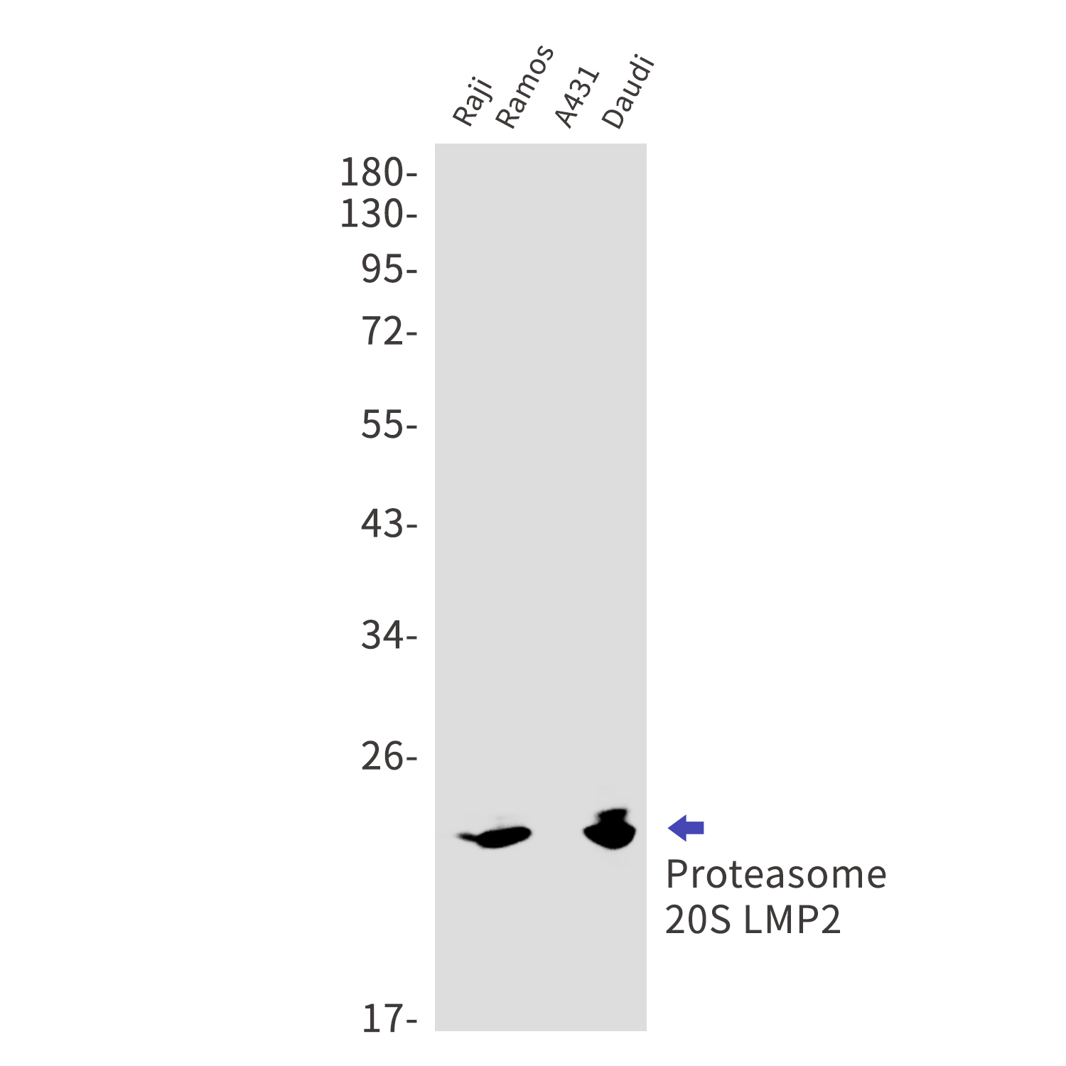 Proteasome beta 9 Rabbit mAb