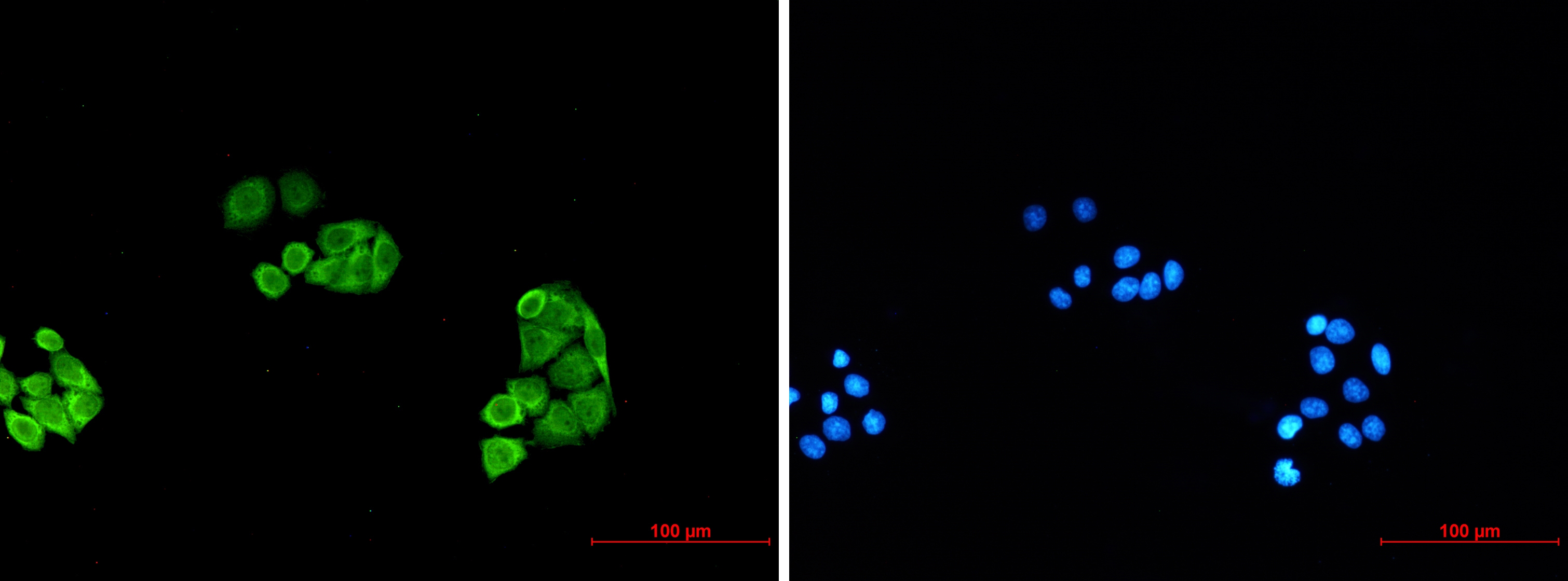 Proteasome alpha 6 Rabbit mAb