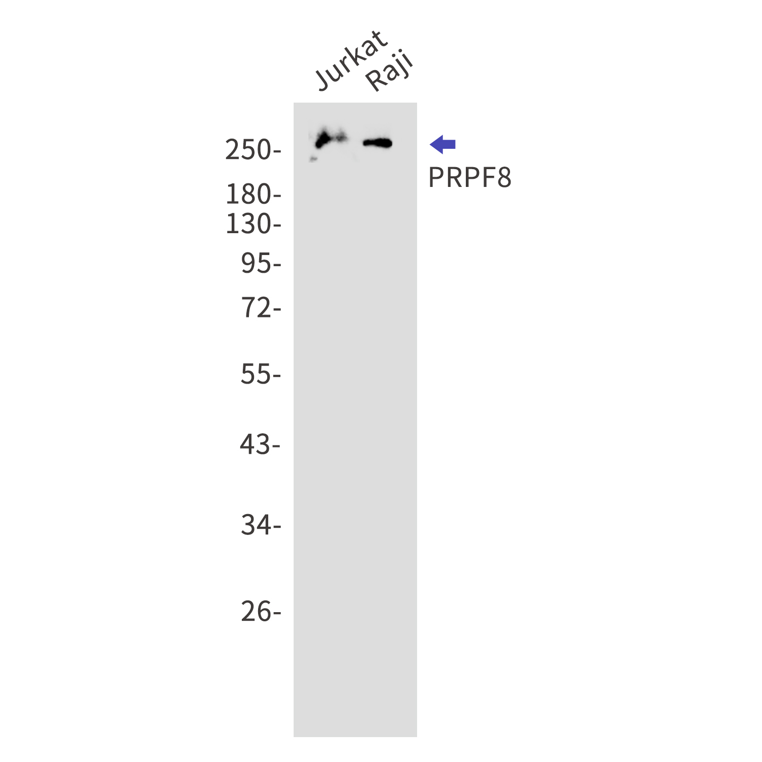 PRPF8 Rabbit mAb